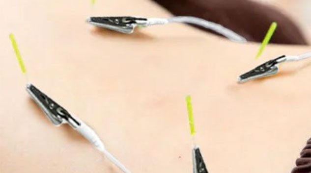 美容・施術ケア